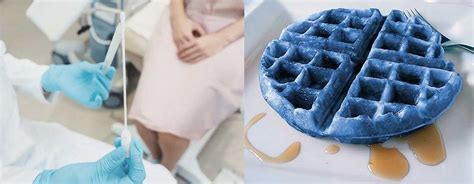 Blue Waffle Disease 